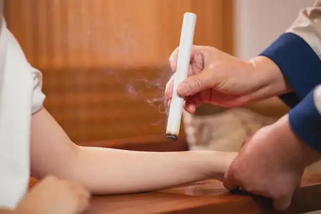 艾灸和拔罐的注意事項！